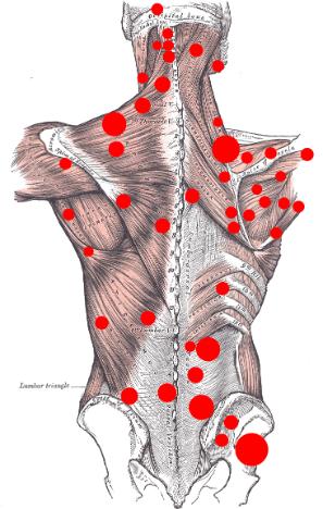 Trigger Points in the human body